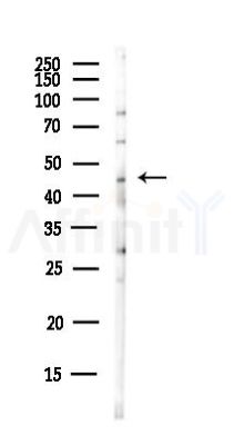 FBXL20 Antibody - Western blot analysis of lysates from HUVEC cells(UV,30min treatment), using FBXL20 Antibody at 1/1000 dilution.