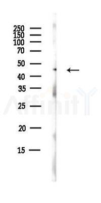 FBXL20 Antibody - Western blot analysis of lysates from B16F10-LUC cells(starvation,24h treatment), using FBXL20 Antibody at 1/1000 dilution.