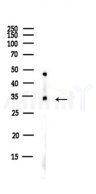 NIPSNAP1 Antibody - Western blot analysis of lysates from HUVEC cells(UV,30min treatment), using NIPSNAP1 Antibody at 1/1000 dilution.