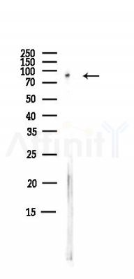 SF3A1 Antibody - Western blot analysis of lysates from B16F10-LUC cells(starvation,24h treatment), using SF3A1 Antibody at 1/1000 dilution.