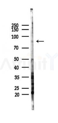 THAP12 Antibody - Western blot analysis of lysates from COLO205 cells(heat-shock,45min treatment), using THAP12 Antibody at 1/1000 dilution.