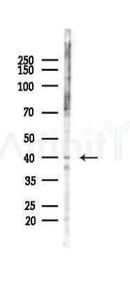 IGBP1 Antibody - Western blot analysis of lysates from COLO205 cells(heat-shock,45min treatment), using IGBP1 Antibody at 1/1000 dilution.
