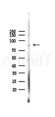 DTX3L Antibody - Western blot analysis of lysates from A375 cells(heat-shock,45min treatment), using DTX3L Antibody at 1/1000 dilution.