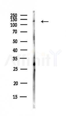 DHX37 Antibody - Western blot analysis of lysates from HUVEC cells(UV,30min treatment), using DHX37 Antibody at 1/1000 dilution.