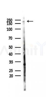 KIF14 Antibody - Western blot analysis of lysates from COLO205 cells(heat-shock,45min treatment), using KIF14 Antibody at 1/1000 dilution.