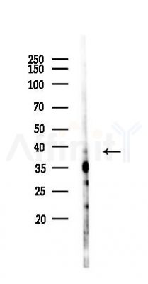 CNMD Antibody - Western blot analysis of lysates from Mouse lung, using CNMD Antibody at 1/1000 dilution.