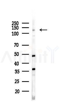 FNDC3A Antibody - Western blot analysis of lysates from A375 cells(heat-shock,45min treatment), using FNDC3A Antibody at 1/1000 dilution.