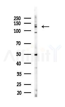 FNDC3A Antibody - Western blot analysis of lysates from LoVo cells(heat-shock,45min treatment), using FNDC3A Antibody at 1/1000 dilution.