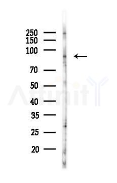 DTL Antibody - Western blot analysis of lysates from A375 cells(heat-shock,45min treatment), using DTL Antibody at 1/1000 dilution.