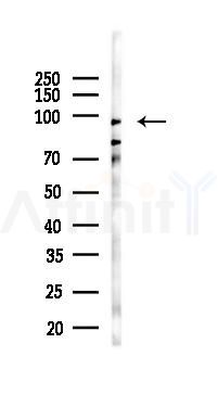 RBM12 Antibody - Western blot analysis of lysates from A375 cells(heat-shock,45min treatment), using RBM12 Antibody at 1/1000 dilution.