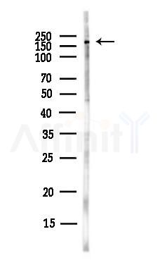 SCAF11 Antibody - Western blot analysis of lysates from Hela cells(UV,30min treatment), using SCAF11 Antibody at 1/1000 dilution.