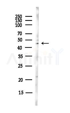 HPN Antibody - Western blot analysis of lysates from Hela cells(UV,30min treatment), using HPN Antibody at 1/1000 dilution.