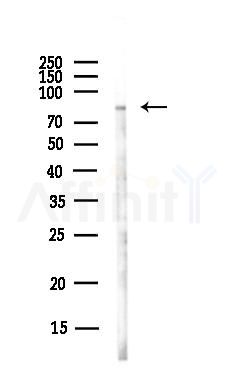 KAZN Antibody - Western blot analysis of lysates from Hela cells(UV,30min treatment), using KAZN Antibody at 1/1000 dilution.