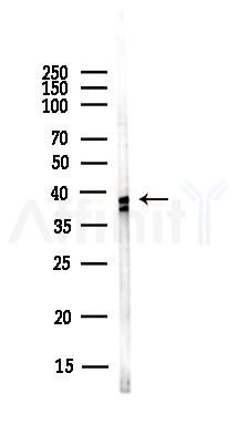 ESAM Antibody - Western blot analysis of lysates from Hela cells(UV,30min treatment), using ESAM Antibody at 1/1000 dilution.