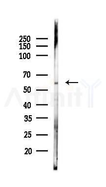 DEAF1 Antibody - Western blot analysis of lysates from A375 cells(heat-shock,45min treatment), using DEAF1 Antibody at 1/1000 dilution.