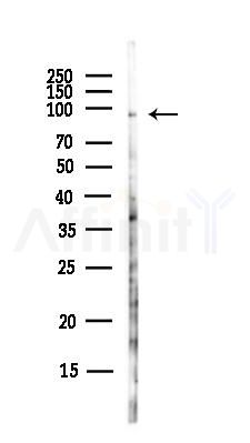 POLK Antibody - Western blot analysis of lysates from Hela cells(UV,30min treatment), using POLK Antibody at 1/1000 dilution.