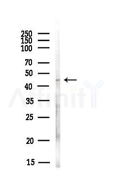 KCNJ1 Antibody - Western blot analysis of lysates from Hela cells(UV,30min treatment), using KCNJ1 Antibody at 1/1000 dilution.