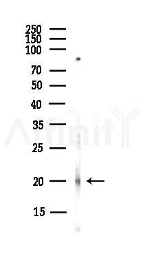 CLEC2A Antibody - Western blot analysis of lysates from Hela cells(UV,30min treatment), using CLEC2A Antibody at 1/1000 dilution.