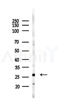 PDF Antibody - Western blot analysis of lysates from A375 cells(heat-shock,45min treatment), using PDF Antibody at 1/1000 dilution.