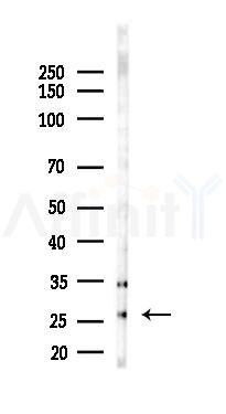 PDF Antibody - Western blot analysis of lysates from LoVo cells(heat-shock,45min treatment), using PDF Antibody at 1/1000 dilution.