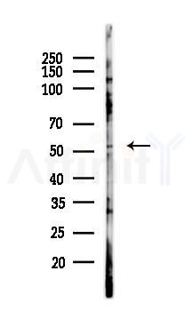 TOM1L1 Antibody - Western blot analysis of lysates from A375 cells(heat-shock,45min treatment), using TOM1L1 Antibody at 1/1000 dilution.