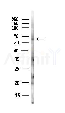 MTPAP Antibody - Western blot analysis of lysates from Hela cells(UV,30min treatment), using MTPAP Antibody at 1/1000 dilution.