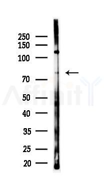 DACT3 Antibody - Western blot analysis of lysates from LoVo cells(heat-shock,45min treatment), using DACT3 Antibody at 1/1000 dilution.