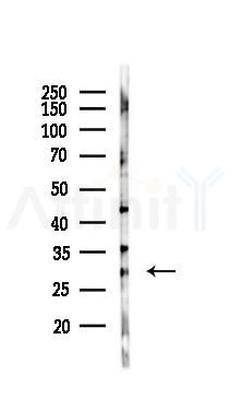 METTL7A Antibody - Western blot analysis of lysates from A375 cells(heat-shock,45min treatment), using METTL7A Antibody at 1/1000 dilution.