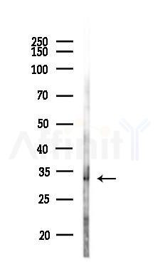 RNPS1 Antibody - Western blot analysis of lysates from Mouse liver, using RNPS1 Antibody at 1/1000 dilution.