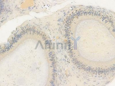 RNPS1 Antibody - DF15782 at 1/100 staining human testicular cancer by IHC-P.