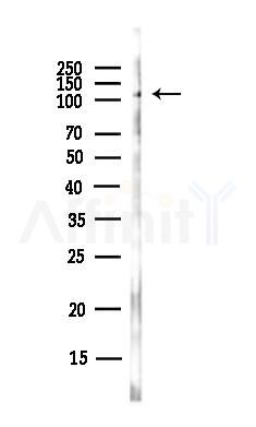 NAA25 Antibody - Western blot analysis of lysates from Hela cells(UV,30min treatment), using NAA25 Antibody at 1/1000 dilution.