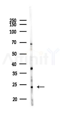 WDYHV1 Antibody - Western blot analysis of lysates from Mouse liver, using WDYHV1 Antibody at 1/1000 dilution.