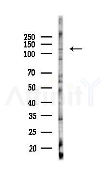 SEC31B Antibody - Western blot analysis of lysates from A375 cells(heat-shock,45min treatment), using SEC31B Antibody at 1/1000 dilution.