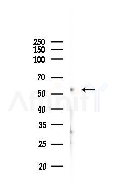 PLAG1 Antibody - Western blot analysis of lysates from Mouse liver, using PLAG1 Antibody at 1/1000 dilution.