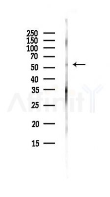PLAG1 Antibody - Western blot analysis of lysates from 3T3-L1 P6(heat-shock, 45min treatment), using PLAG1 Antibody at 1/1000 dilution.