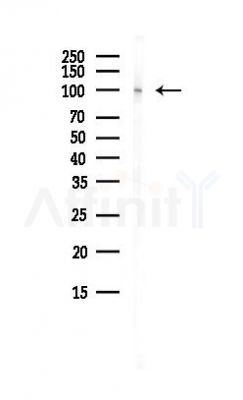 MAP7 Antibody - Western blot analysis of lysates from Hela cells(heat-shock, 45min treatment), using MAP7 Antibody at 1/1000 dilution.