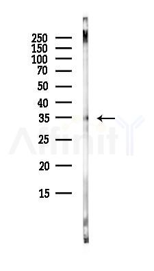 SLC25A28 Antibody - Western blot analysis of lysates from 3T3-L1 P6(heat-shock, 45min treatment), using SLC25A28 Antibody at 1/1000 dilution.