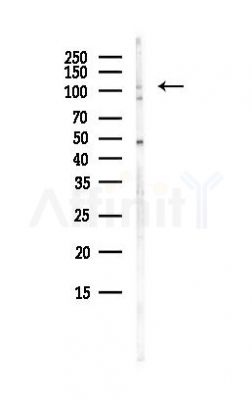 SMG8 Antibody - Western blot analysis of lysates from Hela cells(heat-shock, 45min treatment), using SMG8 Antibody at 1/1000 dilution.