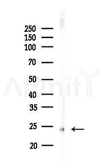 TMEM187 Antibody - Western blot analysis of lysates from Rat liver, using TMEM187 Antibody at 1/1000 dilution.