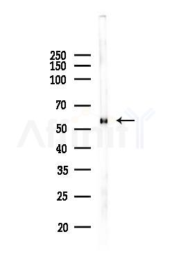 DGCR2 Antibody - Western blot analysis of lysates from Mouse liver, using DGCR2 Antibody at 1/1000 dilution.