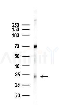 EURL Antibody - Western blot analysis of lysates from PC12 cells(UV, 30min treatment), using EURL Antibody at 1/1000 dilution.