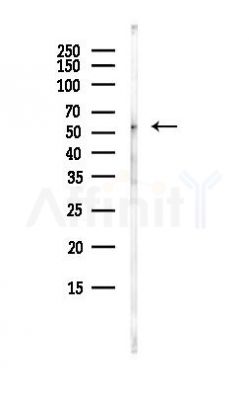 PLXDC1 Antibody - Western blot analysis of lysates from Hela cells(heat-shock, 45min treatment), using PLXDC1 Antibody at 1/1000 dilution.