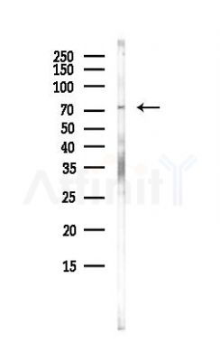 ANO10 Antibody - Western blot analysis of lysates from Hela cells(heat-shock, 45min treatment), using ANO10 Antibody at 1/1000 dilution.