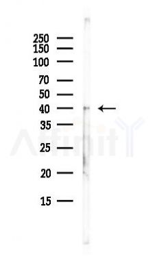 QPCTL Antibody - Western blot analysis of lysates from Hela cells(heat-shock, 45min treatment), using QPCTL Antibody at 1/1000 dilution.
