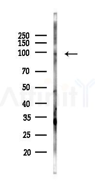 ZBTB10 Antibody - Western blot analysis of lysates from PC12 cells(UV, 30min treatment), using ZBTB10 Antibody at 1/1000 dilution.