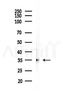 ABI3 Antibody - Western blot analysis of lysates from PC12 cells(UV, 30min treatment), using ABI3 Antibody at 1/1000 dilution.