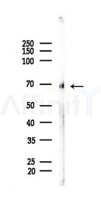 ENTPD7 Antibody - Western blot analysis of lysates from LoVo cells(heat-shock, 45min treatment), using ENTPD7 Antibody at 1/1000 dilution.
