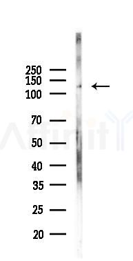 BRPF3 Antibody - Western blot analysis of lysates from PC12 cells(UV, 30min treatment), using BRPF3 Antibody at 1/1000 dilution.