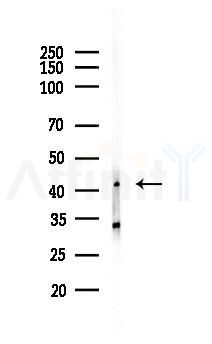 CLVS1 Antibody - Western blot analysis of lysates from PC12 cells(UV, 30min treatment), using CLVS1 Antibody at 1/1000 dilution.