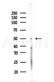 TMEM123 Antibody - Western blot analysis of lysates from Rat liver, using TMEM123 Antibody at 1/1000 dilution.